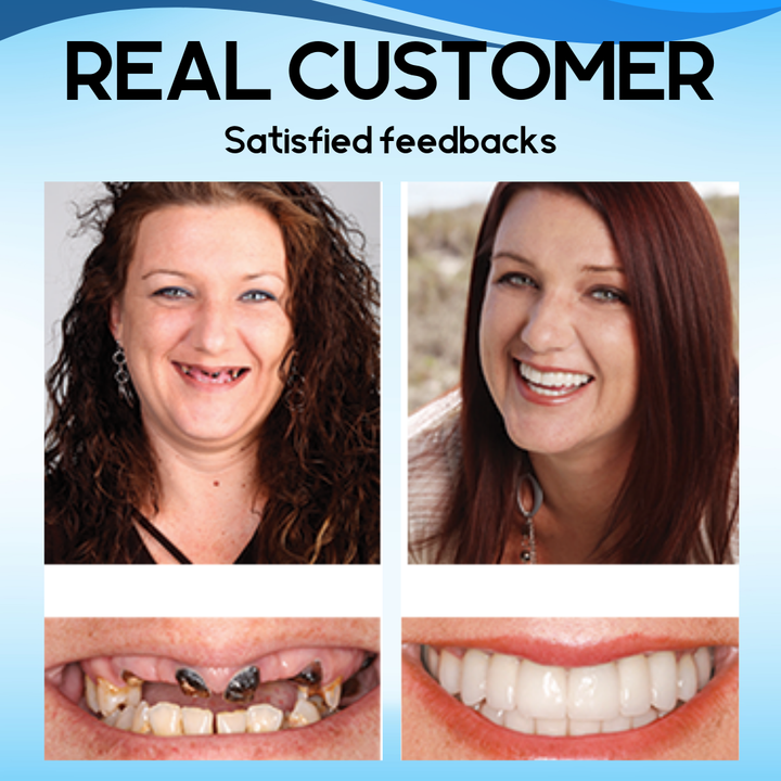 AEXZR™ Silicone reline denture set