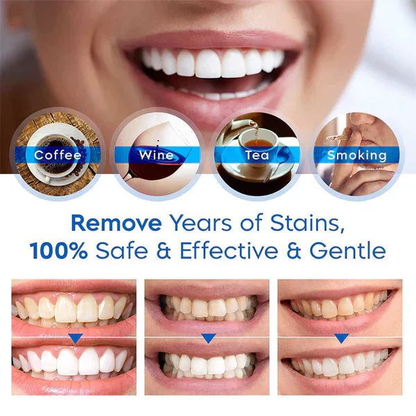 GlowDent™ Teeth Whitening Serum