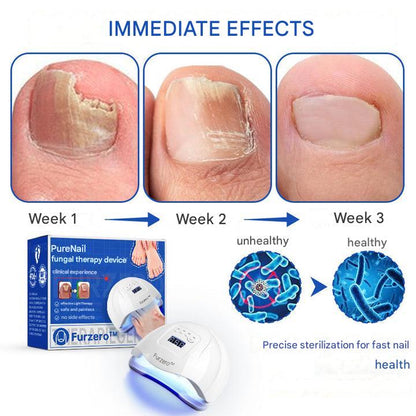 ClearZap+™ Fungal Light Therapy Device | A quick, effective and painless solution!