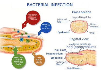ClearZap+™ Fungal Light Therapy Device | A quick, effective and painless solution!