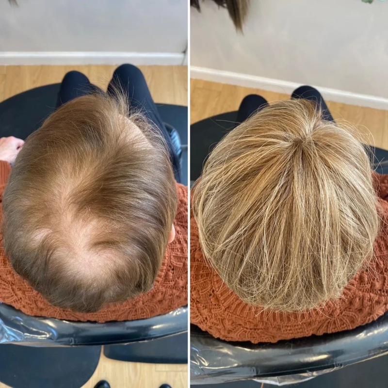 CrownLift+™️ Soft hairpiece | Thick hair run seconds!