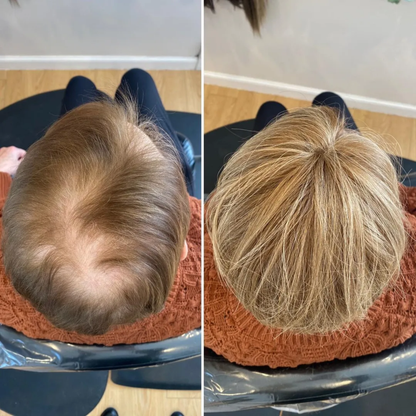 CrownLift+™️ Soft hairpiece | Thick hair run seconds!