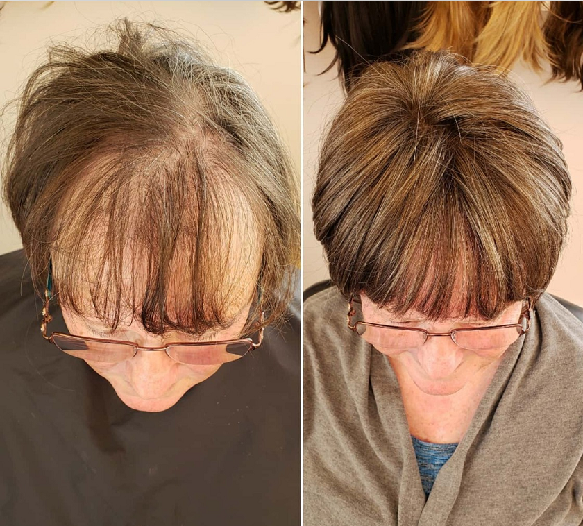 CrownLift+™️ Soft hairpiece | Thick hair run seconds!