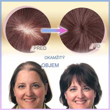 CrownLift+™️ Soft hairpiece | Thick hair run seconds!