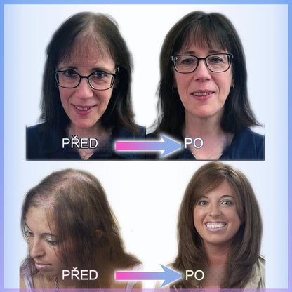 CrownLift+™️ Soft hairpiece | Thick hair run seconds!