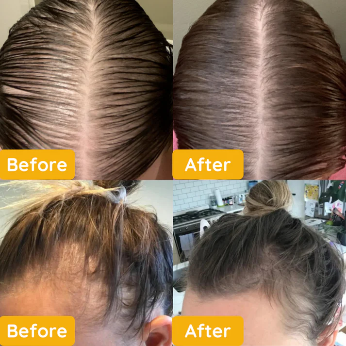 EELHOE Veghair™ Essential Oil for Hair Growth