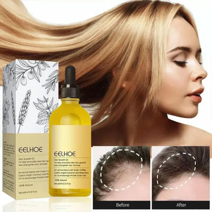EELHOE Veghair™ Essential Oil for Hair Growth