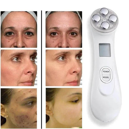 Revita Glow™ Massage device for skin lifting