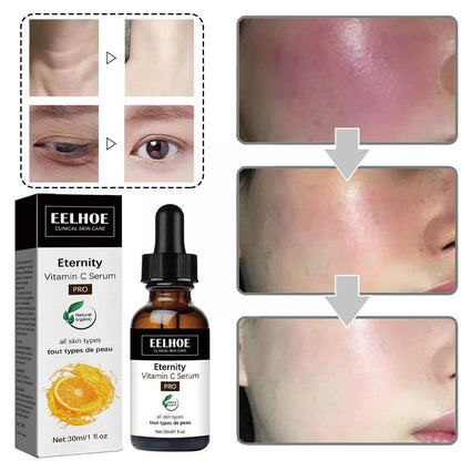 EELHOE Eternity™  Skin Serum Correcting Dark Spots