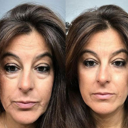 VerfonsEyes™️ Peptide cream for eyes and wrinkles