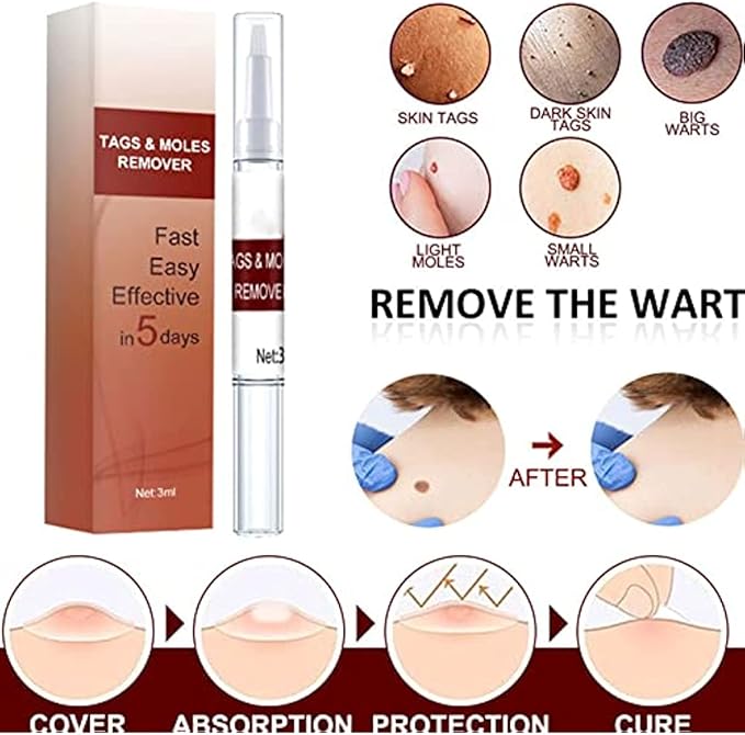 ZapWipe™ Freckle and mole remover