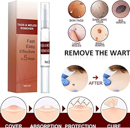 ZapWipe™ Freckle and mole remover