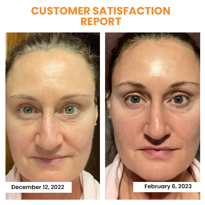 EELHOE™ Anti-wrinkle cosmetics 2 in 1