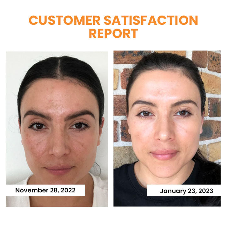 EELHOE™ Anti-wrinkle cosmetics 2 in 1